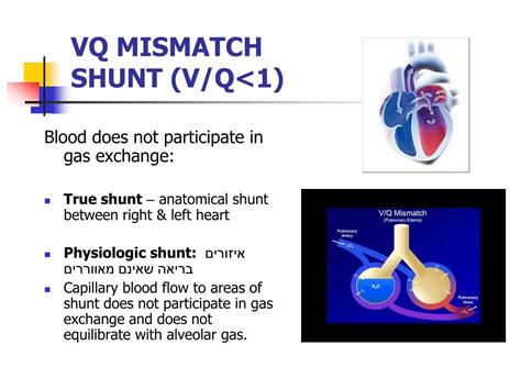 vq mismatch vs shunt